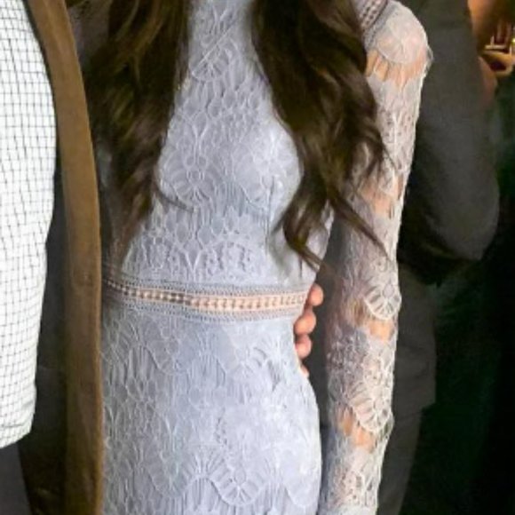 Lace Dress LIKE NEW xs - Picture 3 of 8